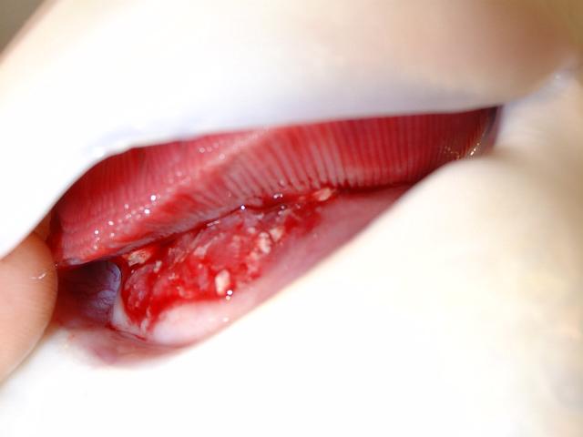Tumor Tag 30